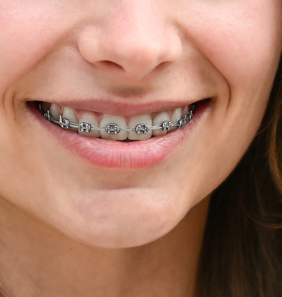 Woman with a healthy smile in Phoenix, AZ